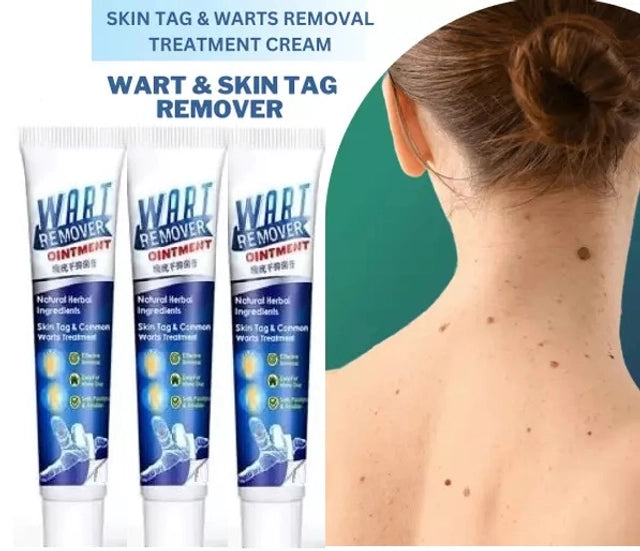 Advanced Wart Remover Cream – Fast & Painless Wart Removal (100g)
